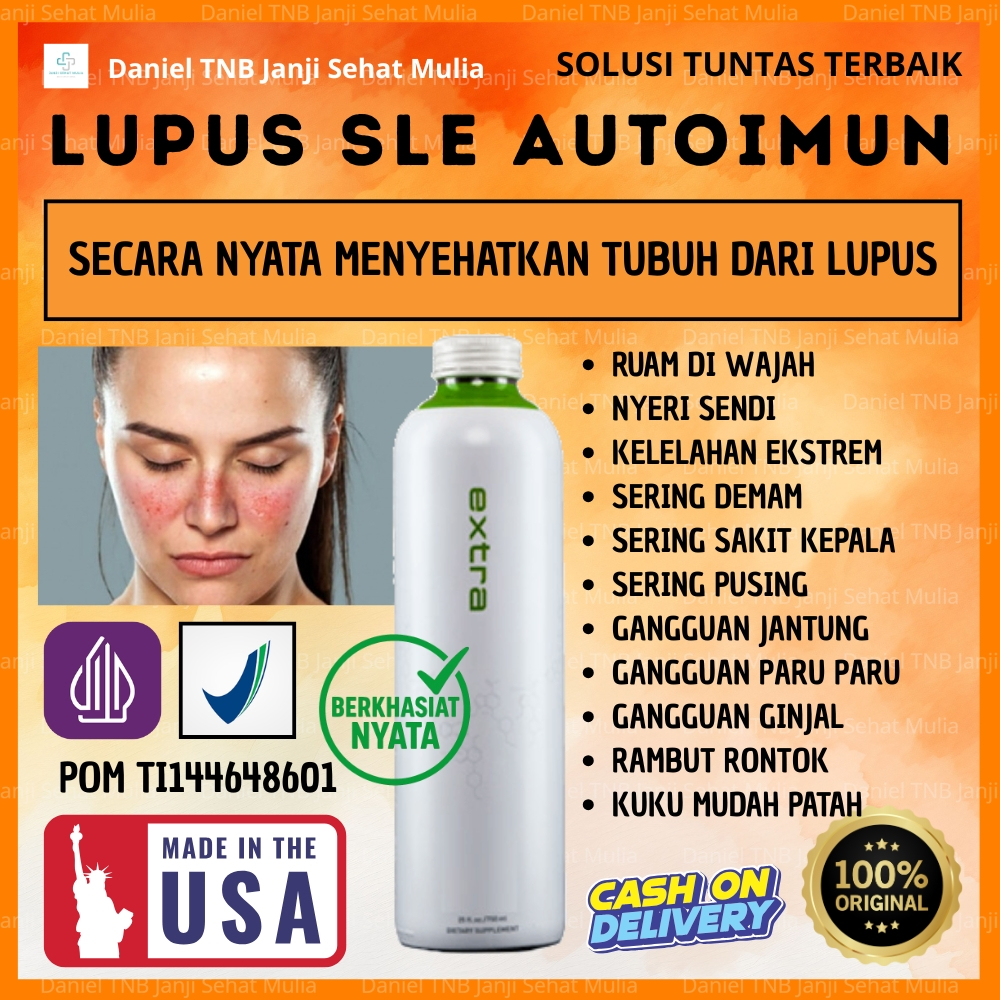 Daniel TNB Obat Herbal Lupus Autoimun SLE Sistemik Lupus Eritematosus