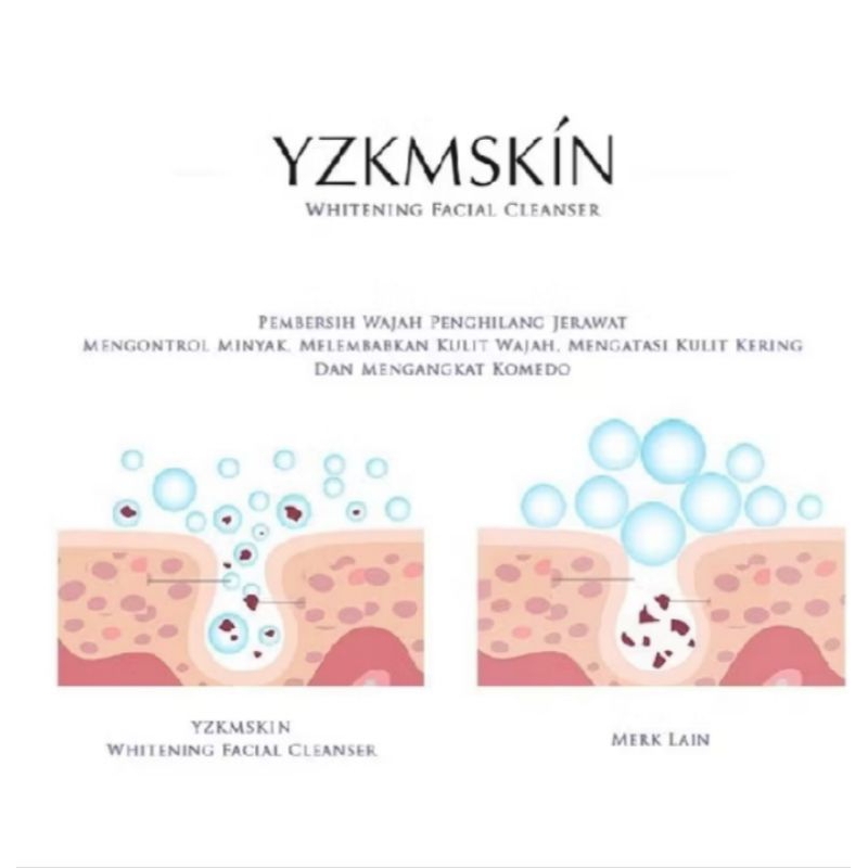 YZKMSKIN