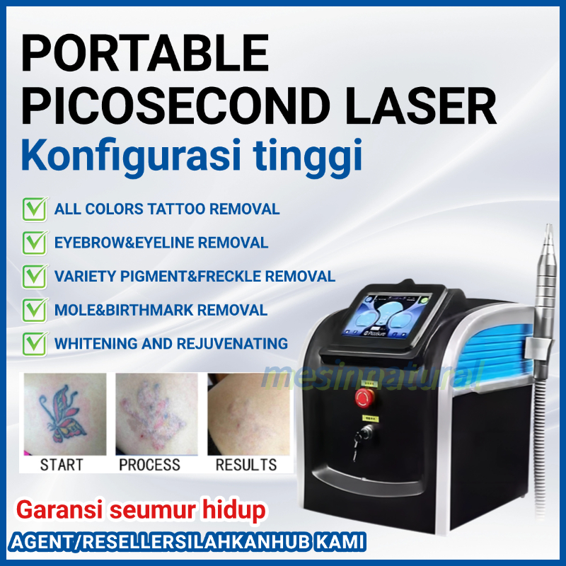 Portabel laser picoway NdYag Laser Pico Alat Clinic Kecantikan bopeng flek hitam wajah bibir hitam  