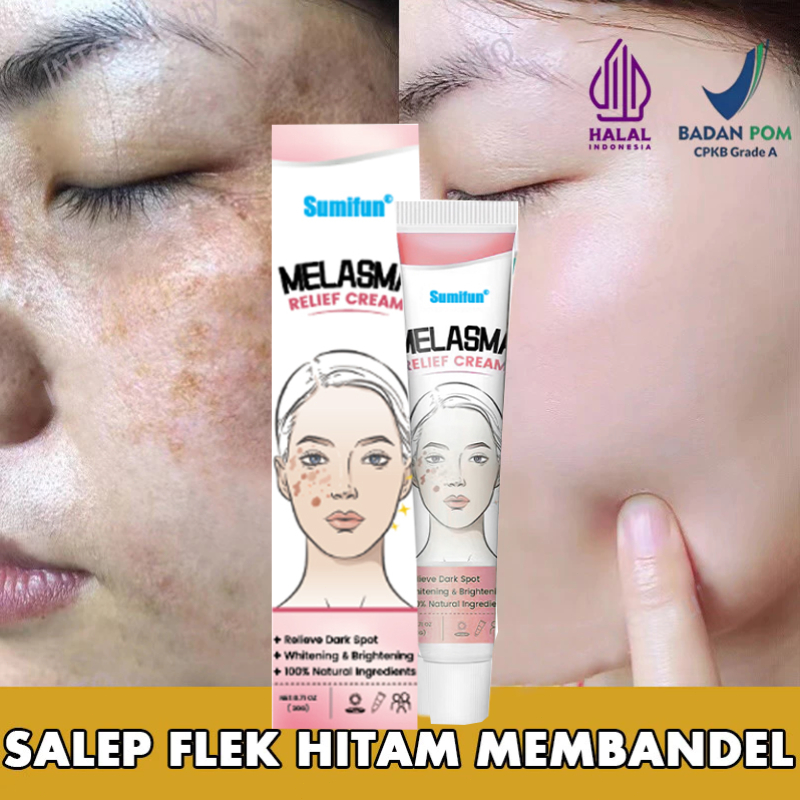 Sumifun cream penghilang flek hitam salep melasma flek hitam membandel 20g cream flek dan kusam/Remo