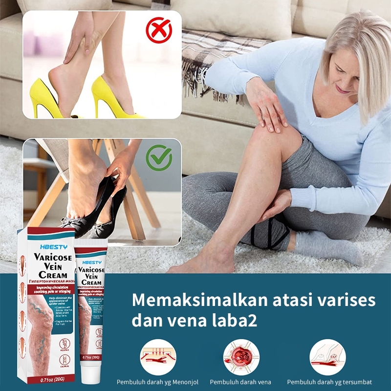 Varicose Veins Spray Obat Varises Salep Penghilang Varises Vaskulitis / Parises Ampuh Tanpa Operasi 