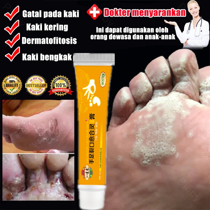NEW Obat Kaki Rayapan dan Bau Obat Kaki Rayapan Penghilang Bau Kaki Obat Kaki Rayapan Paling Salep