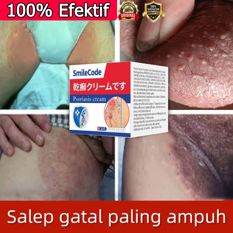 （100% Efektif） Salep gatal paling ampuh obat gatal selangkangan salap gatal kulit yang ampuh obat ga
