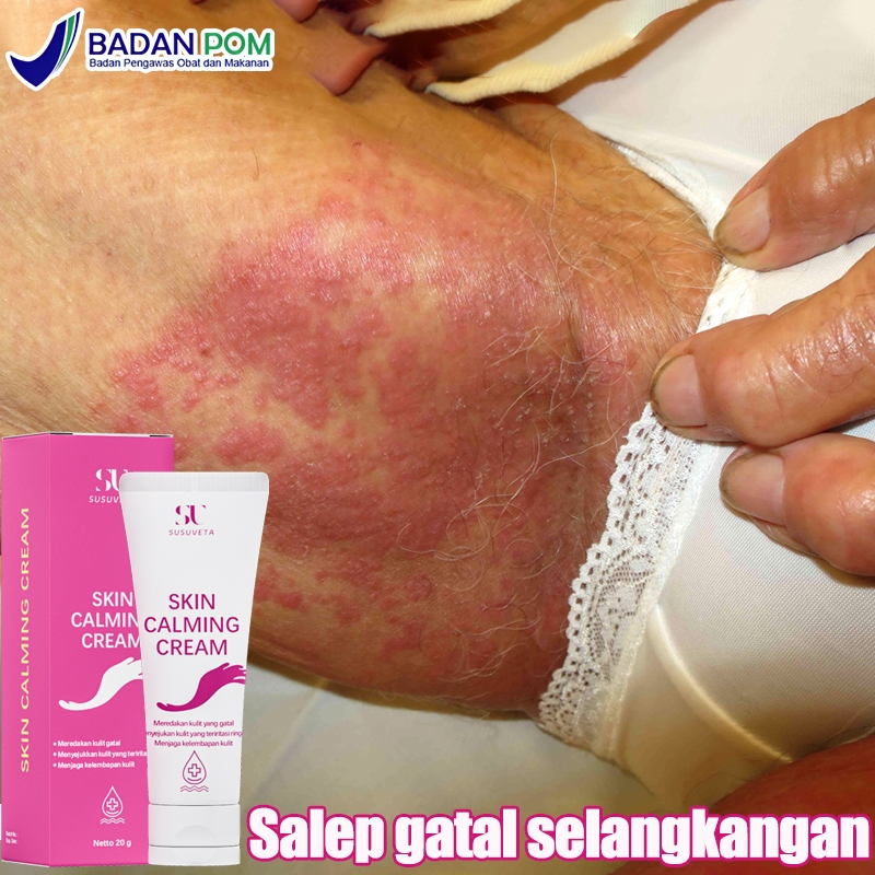 Salep gatal selangkangan Salep china gatal paling ampuh Obat gatal gatal 20g SUSUVETA Obat gatal sel