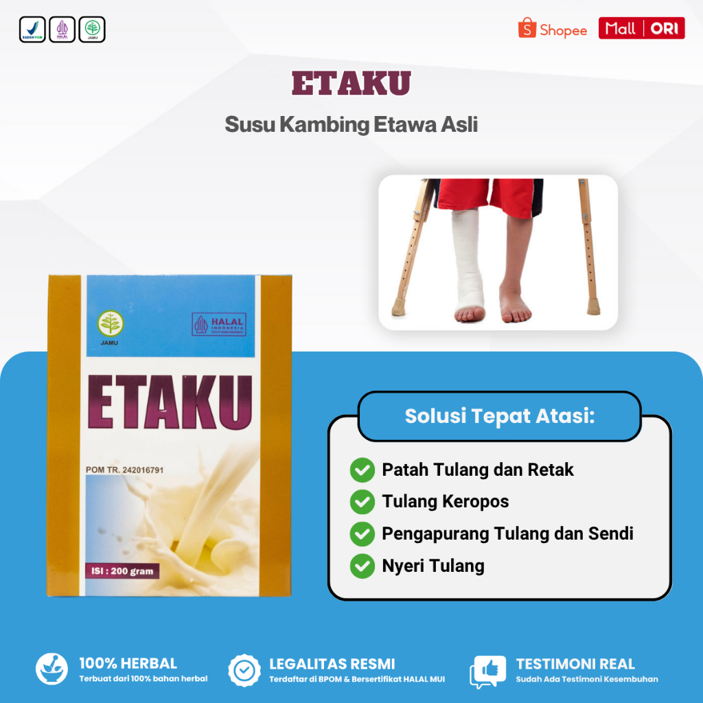 

Obat Patah Tulang & Retak, Patah Tulang Kaki Tangan Rusuk Pinggul Selangka Bahu - Etaku Susu Kambing