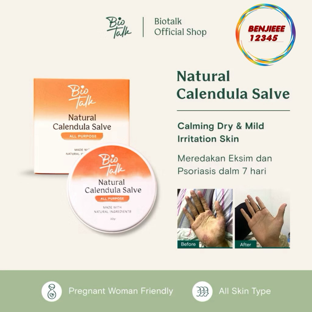 Biotalk Natural Calendula Salve meredakan kulit eksim psoriasis sensitif gatal gatal biotalk Bio Tal