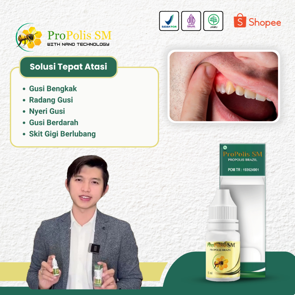 Obat Gusi Bengkak, Radang Gusi, Nyeri Gusi, Gusi Berdarah, Sakit Gigi Berlubang - Propolis SM