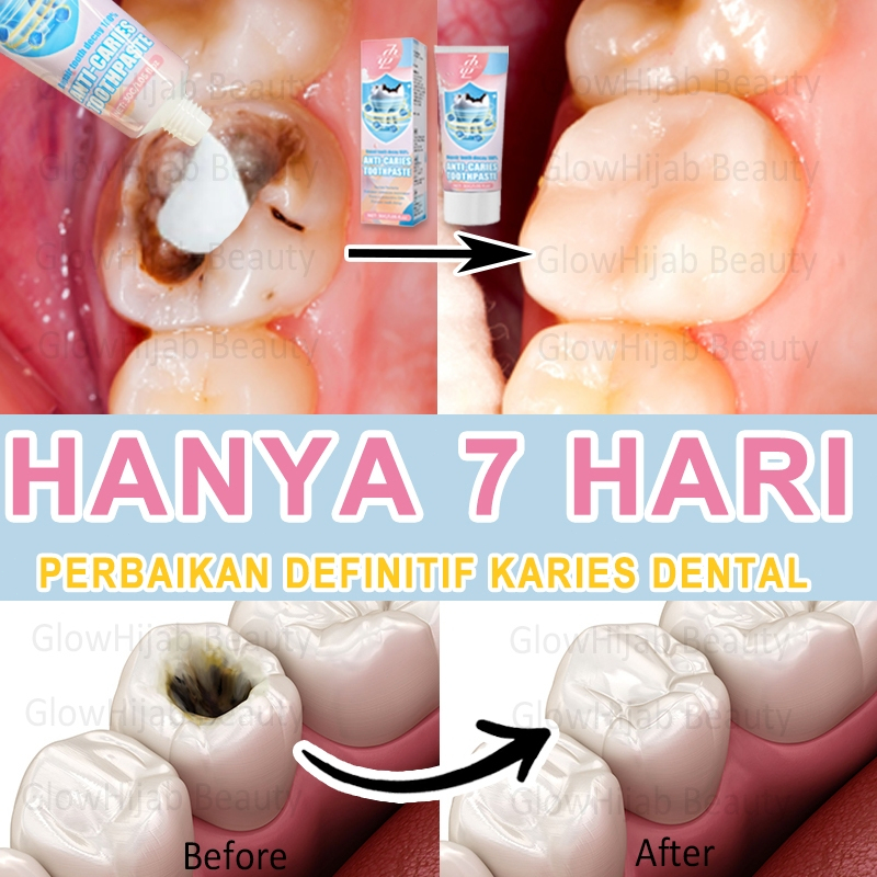 ZKRICARO Pasta gigi anti-karies memutihkan gigi dan memperkuat email gigi, menjaga gigi tetap kuat d