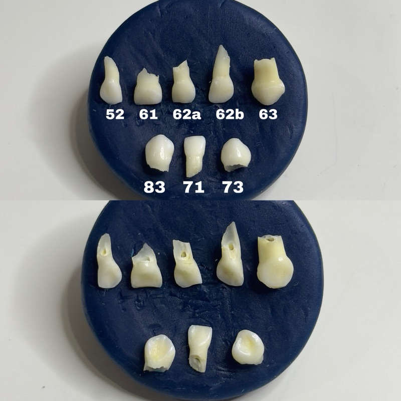 gigi praktikum pedo anterior anak sulung molar insisive insisif akar