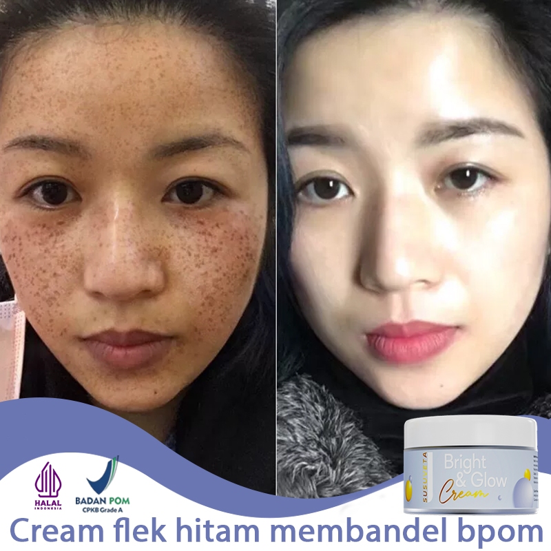 Night cream penghilang flek hitam salep flek hitam membandel cream flek hitam membandel 30g cream pe