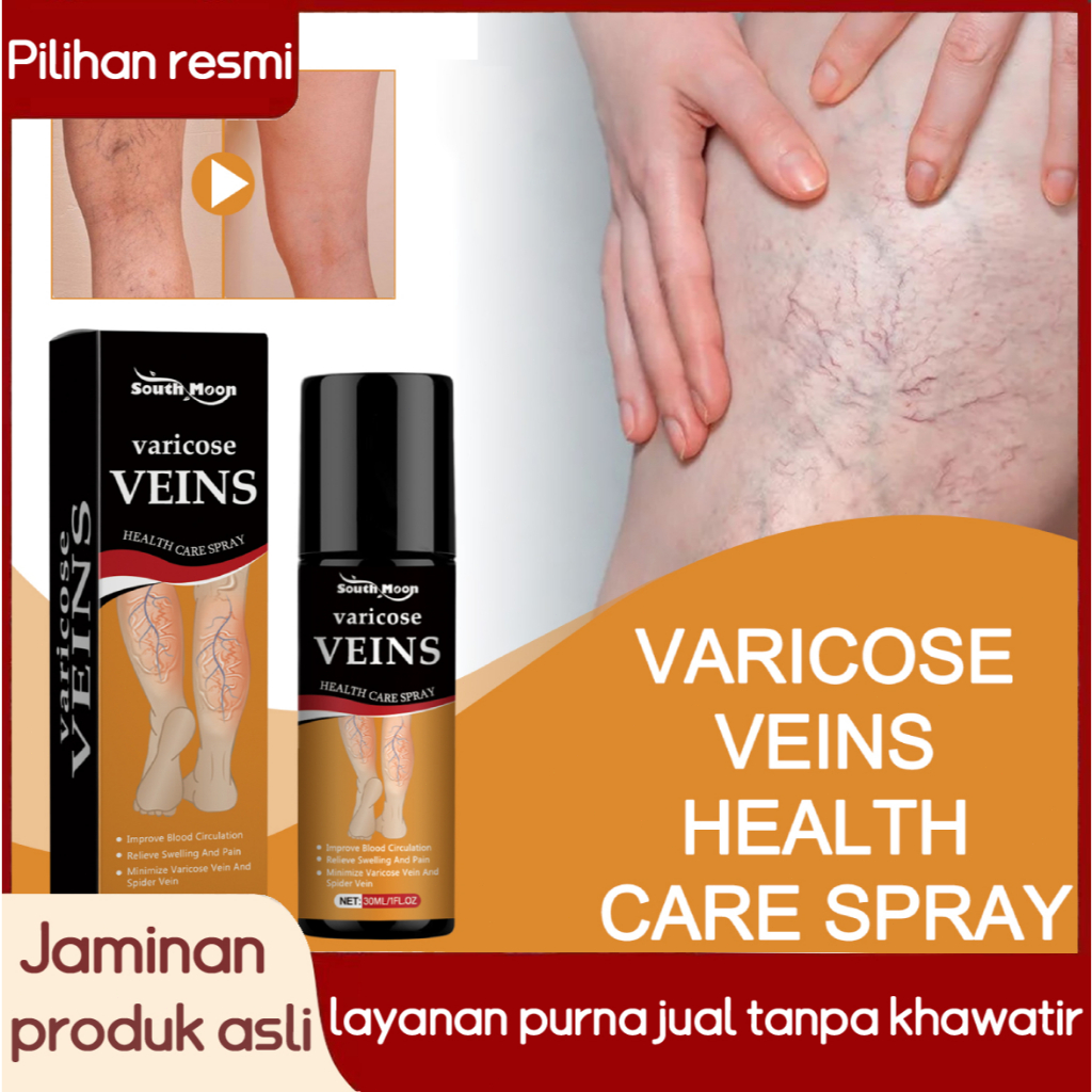 South Moon Semprotan Varises Semprotan untuk meredakan rasa sakit, pembengkakan, varises, kaki seper