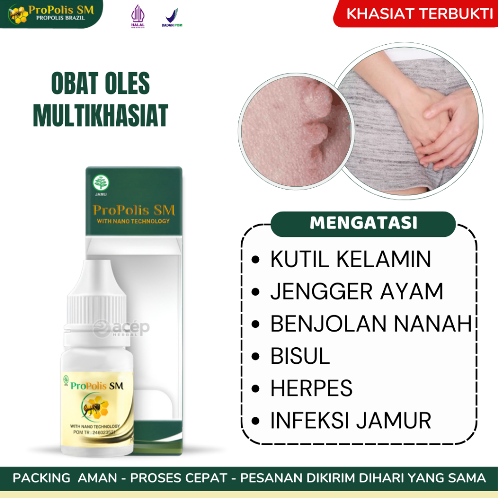 Propolis Untuk Miss V Kutil Kelamin Jengger Ayam Benjolan Bernanah Bisul Herpes Infeksi Jamur