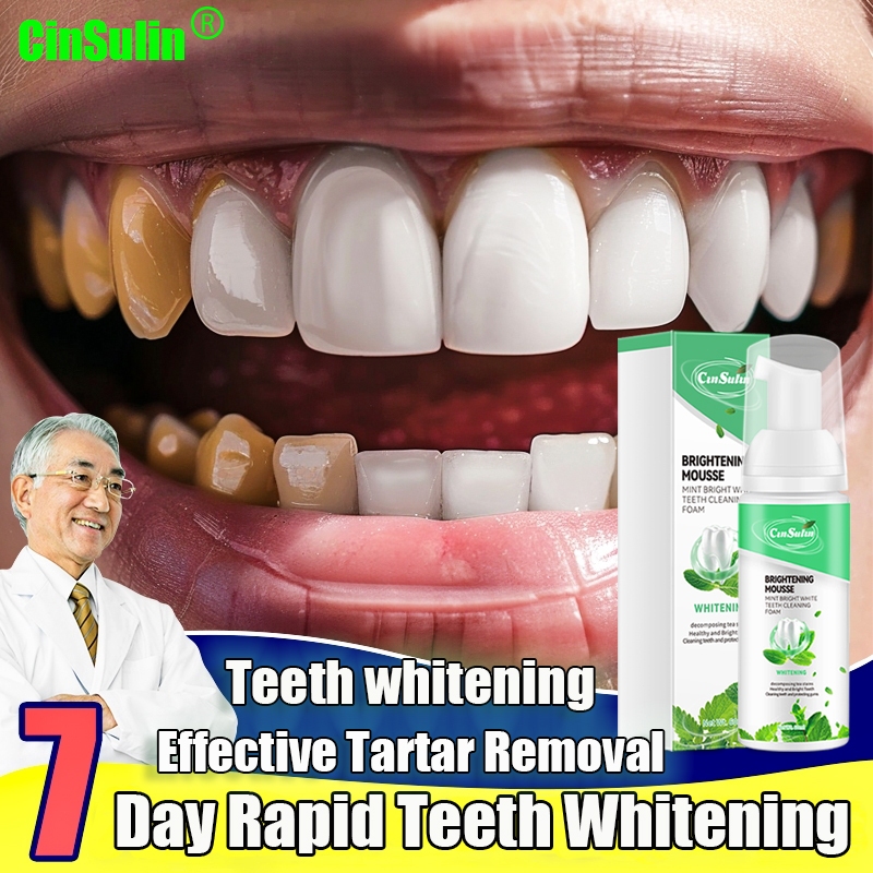 | 100% AMPUH | Pemutih Gigi Permanen Teeth Whitening Asli Bpom Ampuh Menghilangkan Gigi Kuning/Peron
