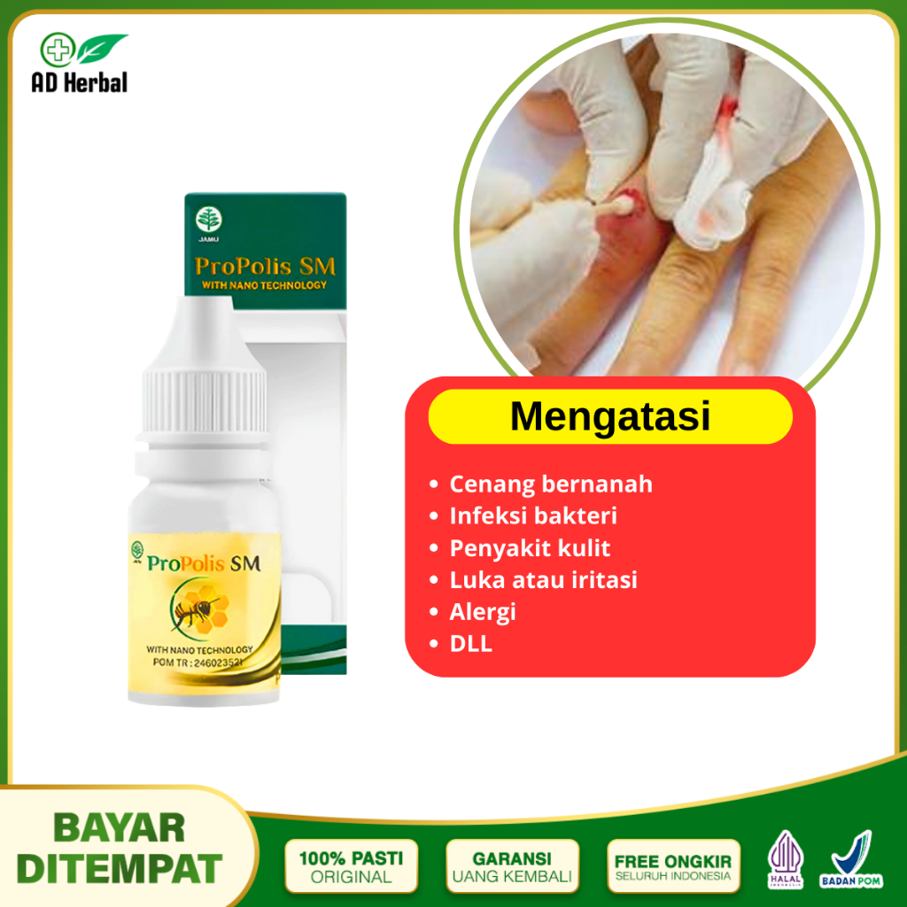 Obat Bisul Bisulan Cenang Benjolan Bernanah Atau Nanahan Propolis SM