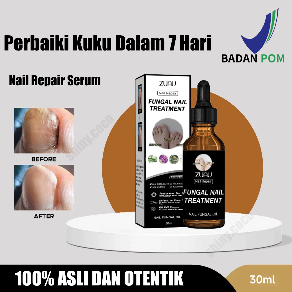 Serum Kuku Obat Kuku Jamur Dan Rusak Obat Kuku Jamur Dan Rusak Obat Jamur Kuku Vitamin Kuku Dan Kuti