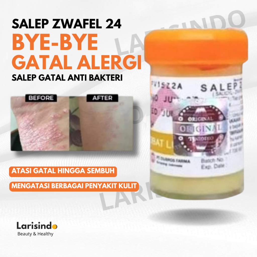 Salep Gatal Zwafel 24  Belerang Sulfur 100% Original BPOM Saleb Gatal Kutu Air Eksim Panu Biduran