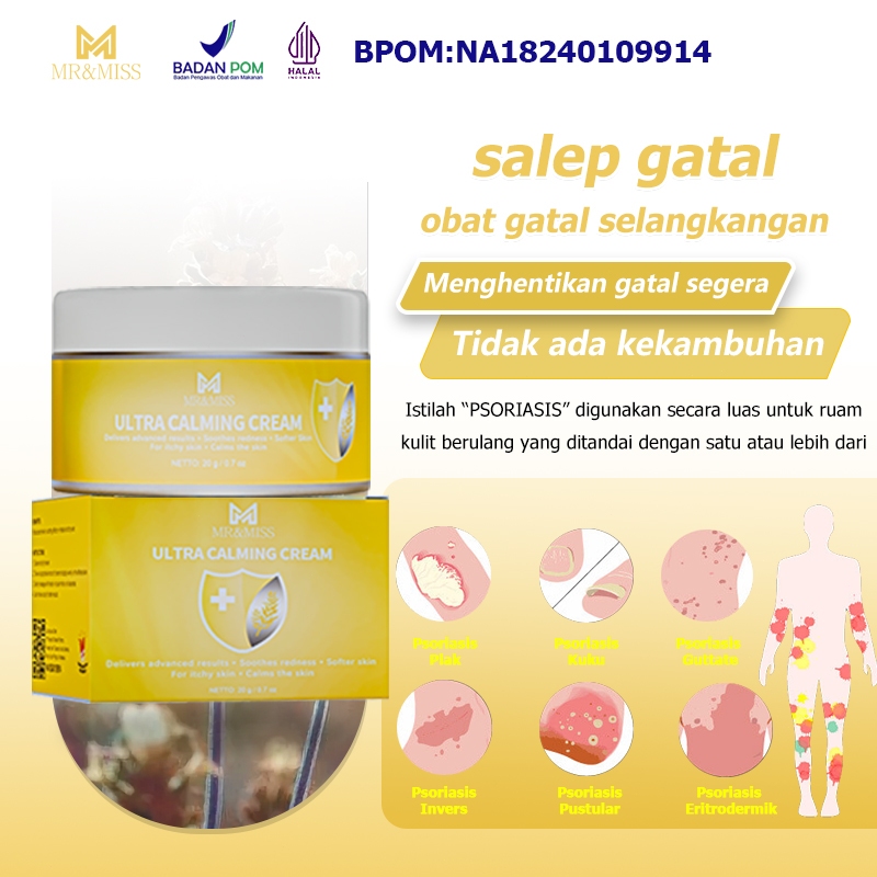 Salep gatal china paling ampuh Salep gatal jamur selangkangan Salep gatal selangkangan 20g Obat gata