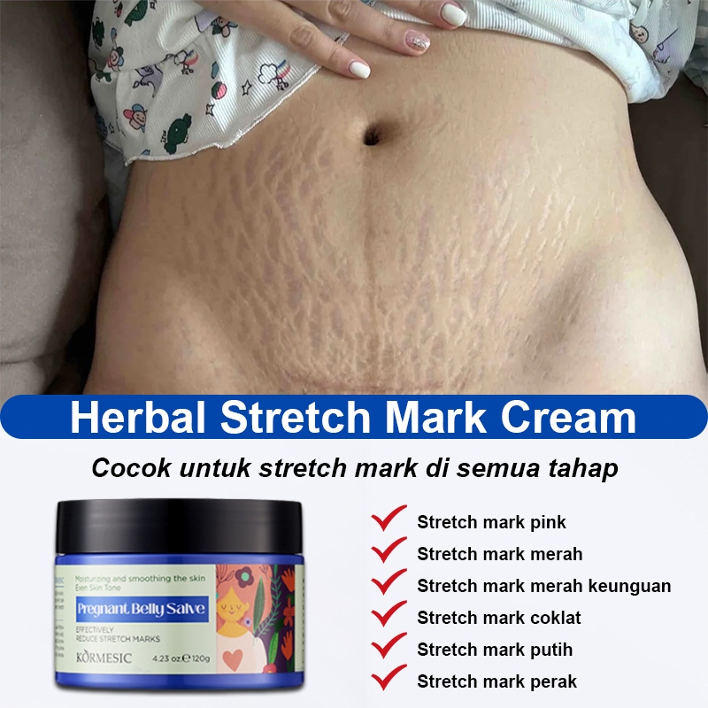 Herbal Stretch Mark Cream Penghilang Strechmark 120g Obat stretch mark untuk perut l paha l dada l b