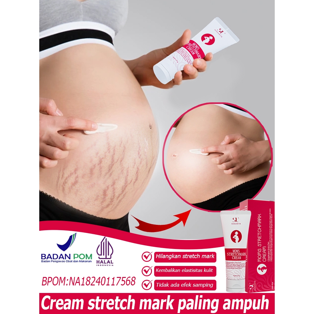 Stretch Mark Cream Penghilang Strechmark Rintik Stretch Mark Cream 20G Cream Stretch Mark Paling