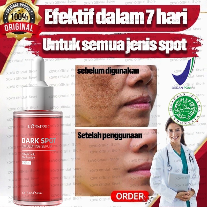 penghilang flek hitam di wajah ampuh bpom Serum Penghilang Flek Hitam Terbaik untuk Wajahmu Perawata