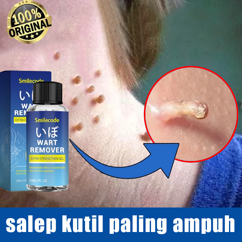 BPOM Wart Remover Original 30ML Obat Kutil Paling Ampuh Oles Salep Penghilang Tahi Lalat Salep Kutil