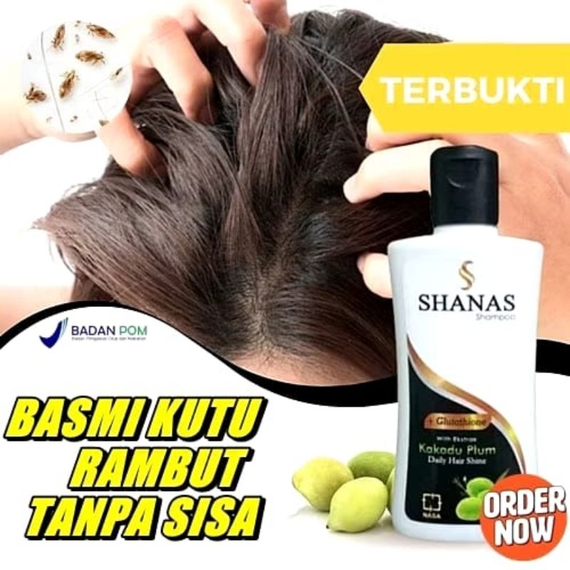 Shampo Shanas anti kutu rambut untuk anak dan ketombe