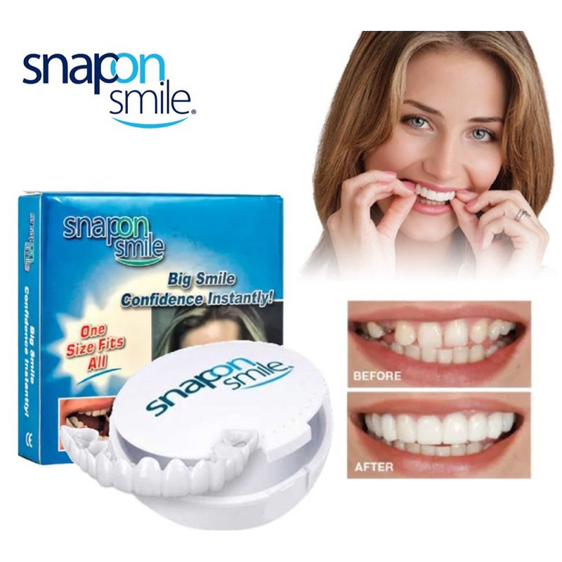 snap on smile / gigi tiruan / veneer / gigipalsu / gigi murah