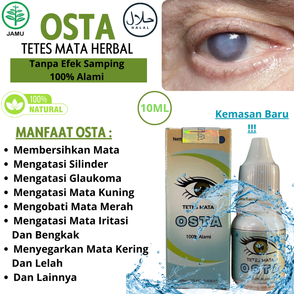 [BESTSELLER] OSTA Obat Tetes Mata Minus Obat Mata Katarak Obat Tetes Mata Pembersih Mata 15ml Tetes 