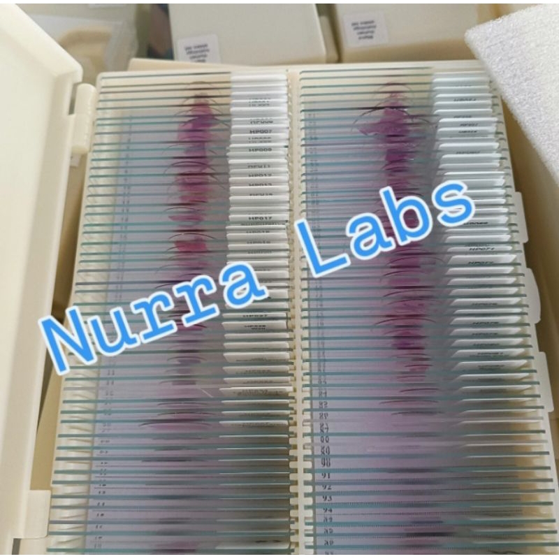 Preparat Phatology Human - Patologi /Pathology Human 100 Slides