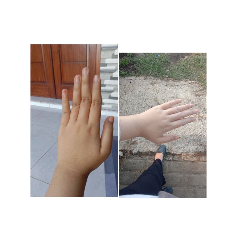 Lotion whitening LV 3