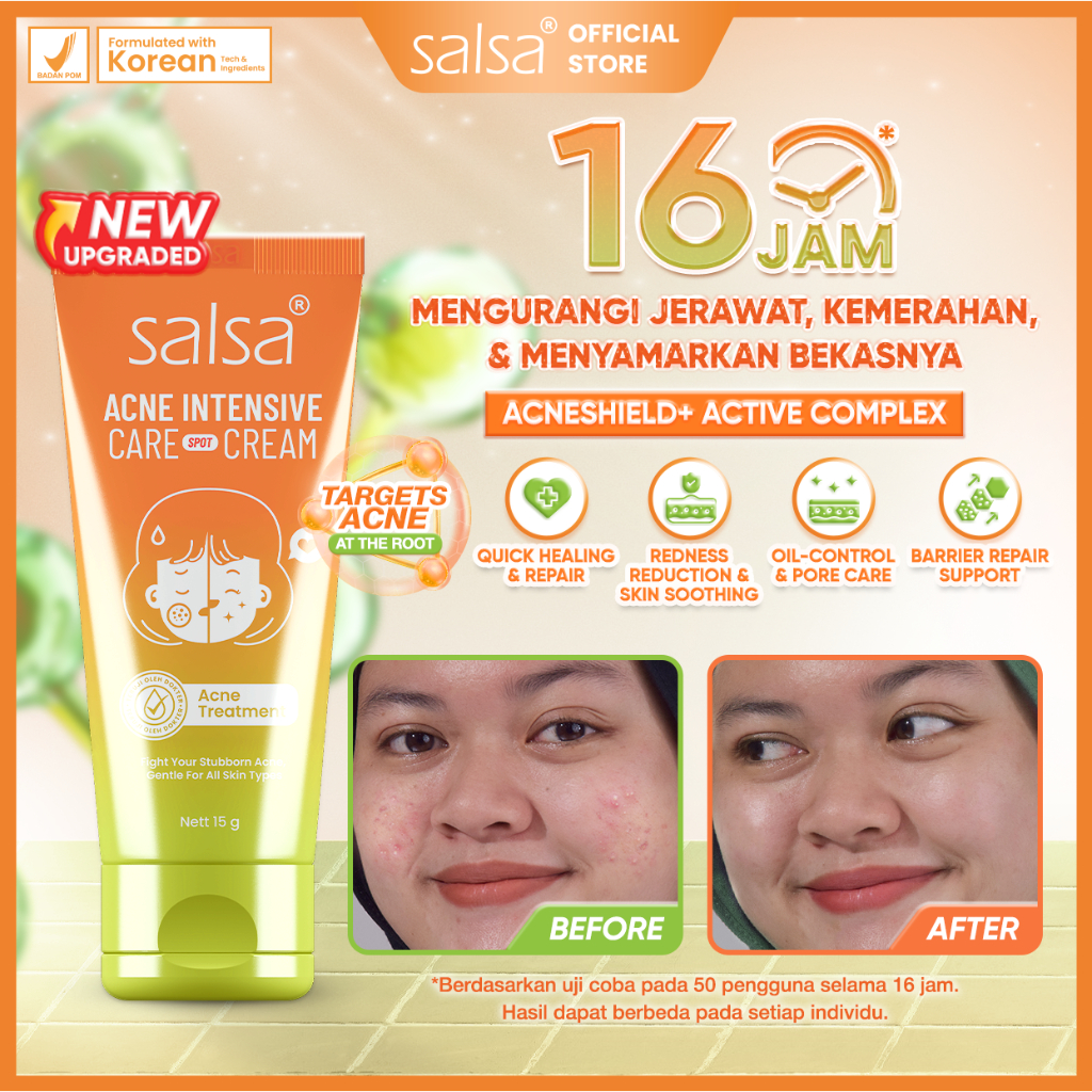 SALSA ACNE SPOT – obat jerawat salep jerawat ance gel anti acne cream | obat totol jerawat pustula p
