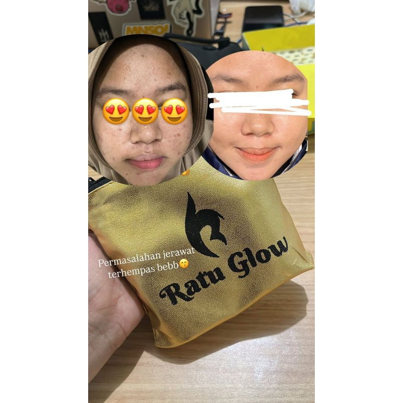 Ratu Glow ekonomis