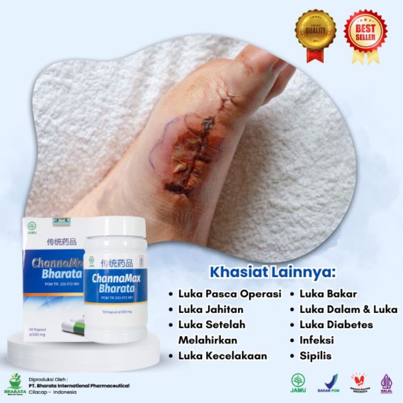 Obat Luka Pasca Operasi - Obat Pengering Luka - Obat Luka Cina Pasca Operasi - Channamax Bharata
