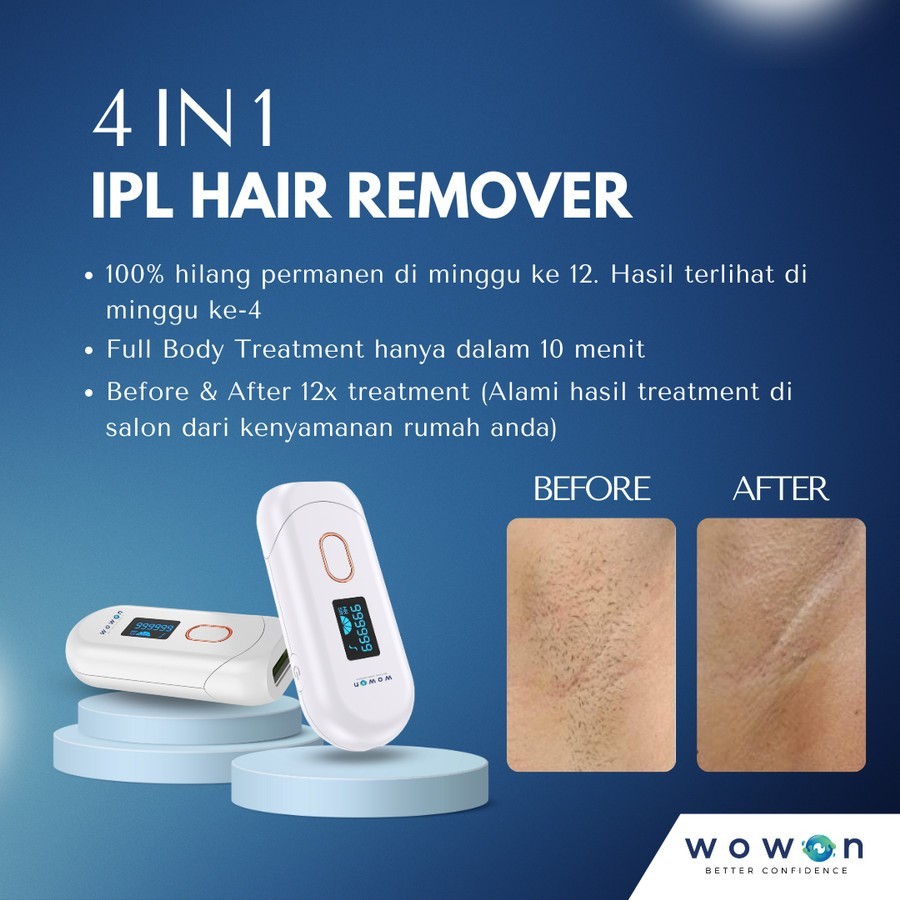 Wowon 4in1 IPL Hair Removal - Alat Penghilang Rambut Secara Permanen