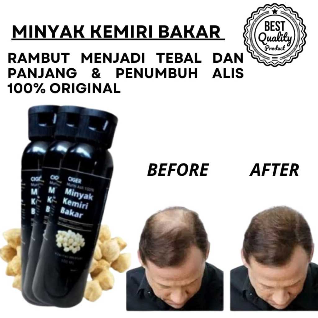 

Minyak Kemiri Bakar 100% Original 30ml Rumah Rempah Manisha