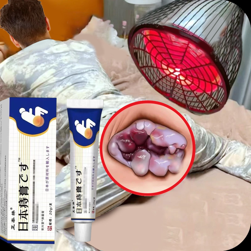 salep wasir ampuh asli china 100% Original Herbal Obat Wasir  salep ambeien paling ampuh 20g