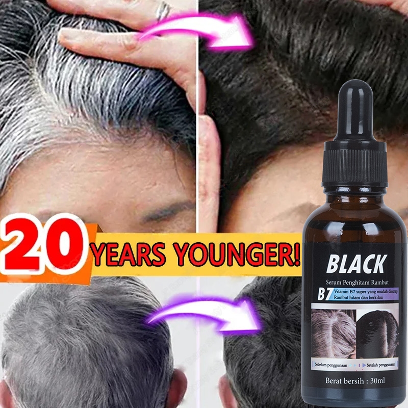 ORIGINAL 100% Rambut Hitam Lebat Secara Permanen Merawat Akar Rambut Bahan Alami Murni Aman Dan Tida