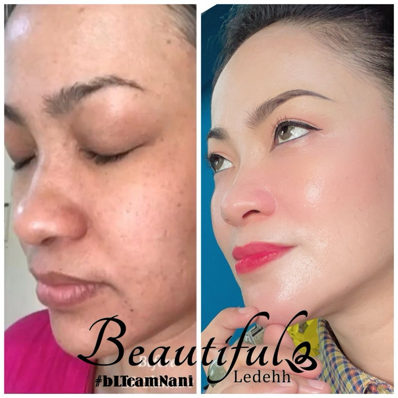 Beautiful Ledeh Skincare