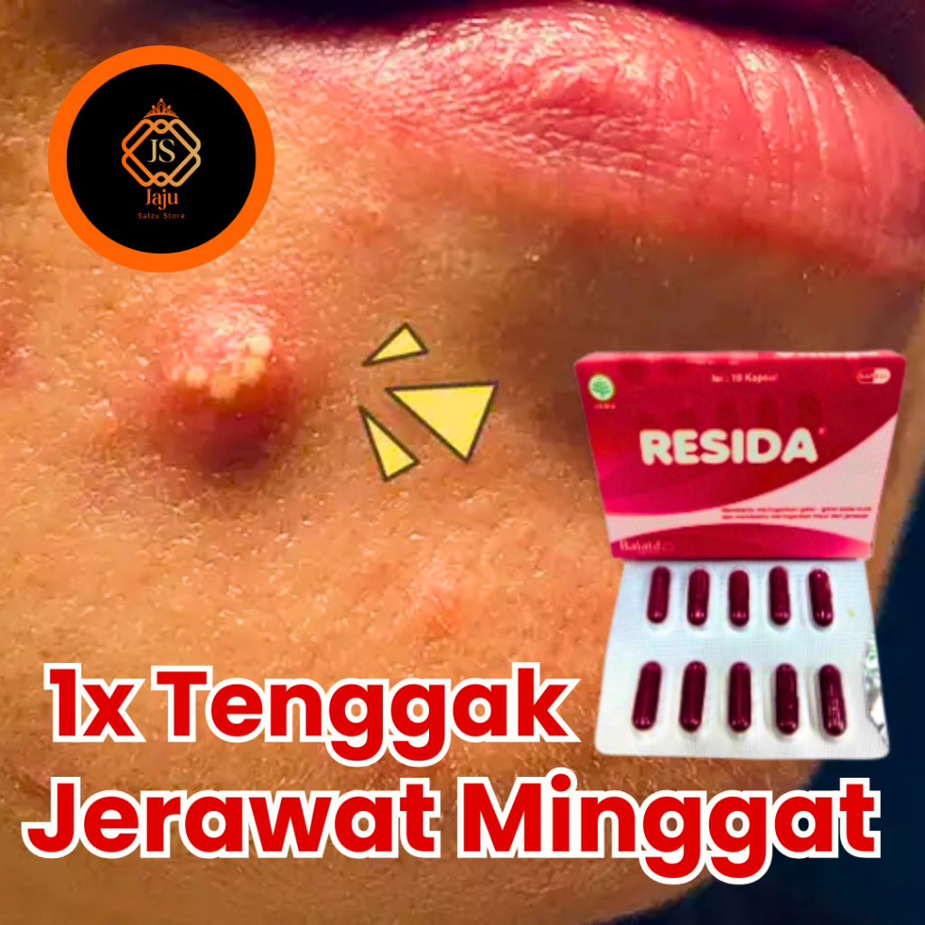 Obat Jerawat Gatal Kulit Selangkangan Jamu Suplemen Penghilang Bisul Alergi Bruntusan Seluruh Badan