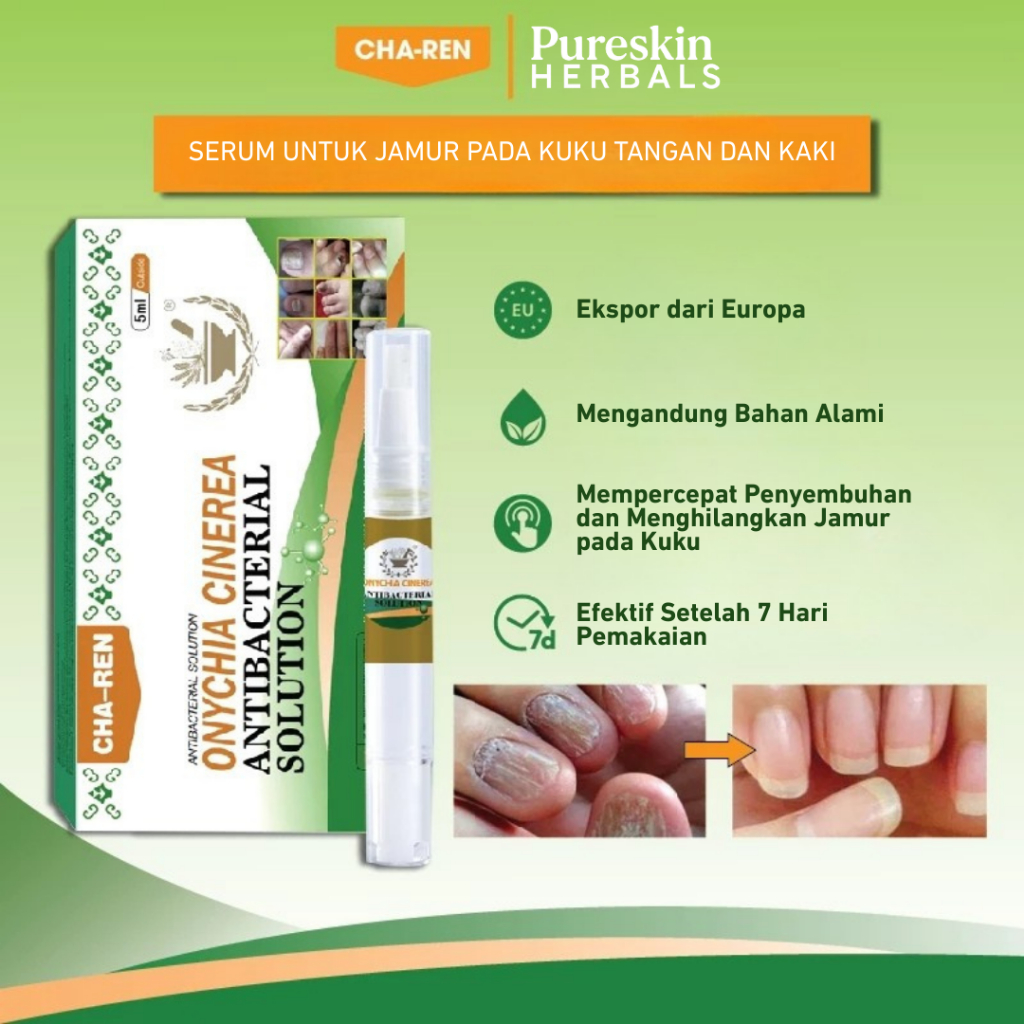 CHA-REN Obat Jamur Kuku Tangan & Kaki, Perawatan Kuku Rusak Herbal Ampuh