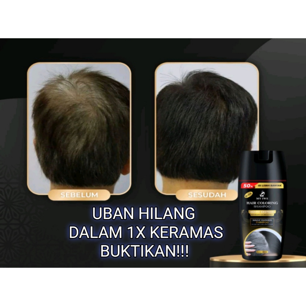 My Iwe shampo penghilang uban penghitam rambut uban