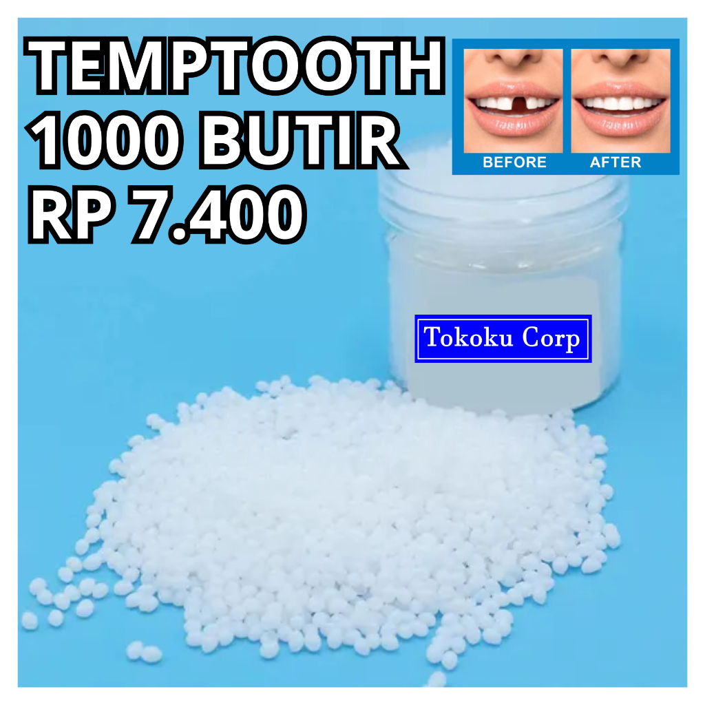 Penambal Gigi 1000 Butir - Temptooth Gigi Palsu isi 1000 Butir