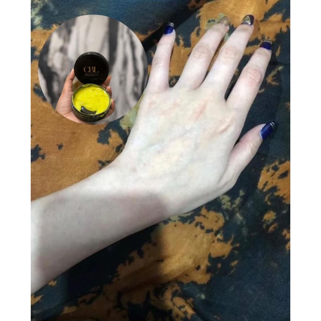 HB Dosting Terampuh BPOM Aman Terbukti Cepat Memutihkan