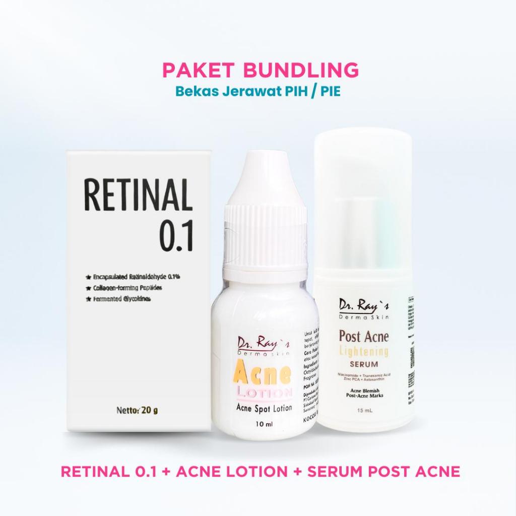 Paket Bundling Bekas Jerawat PIH/PIE