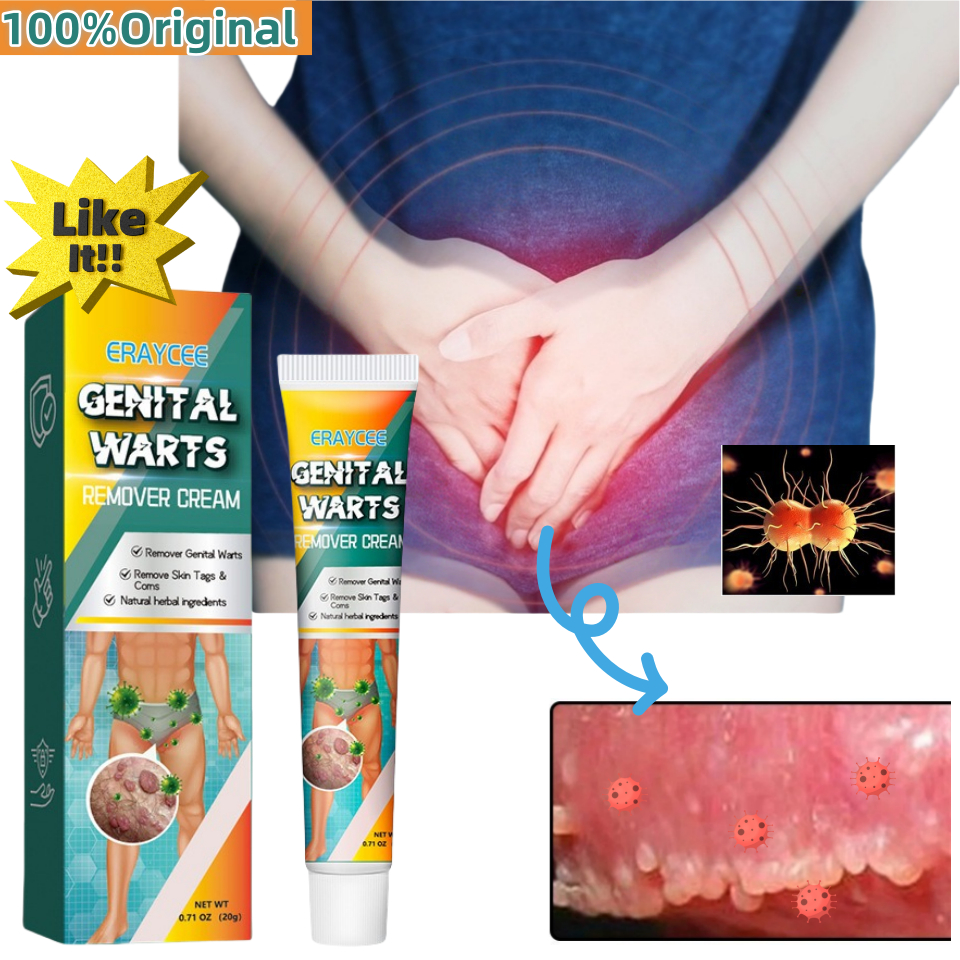 Obat Kutil Kelamin Pria Dan Wanita Penghilang Kutil Dan Tahi Lalat Penghilang Kutil Kelamin 20g Sale