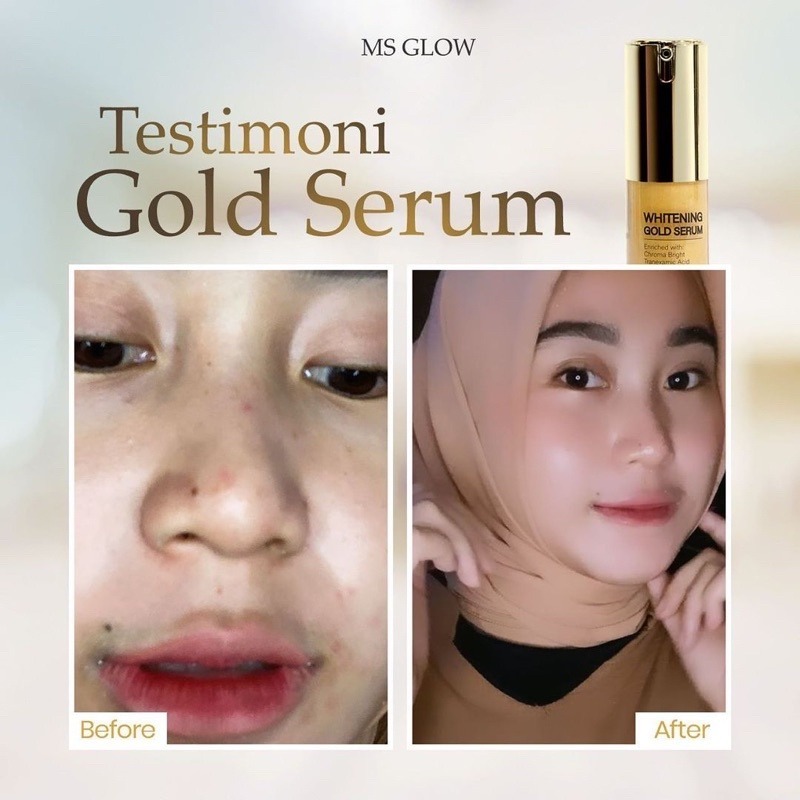 Serum Gold Ms Glow Ultimate Menghilangkan Flek Hitam Ms Glow Serum Whitening Gold Pasti Promo