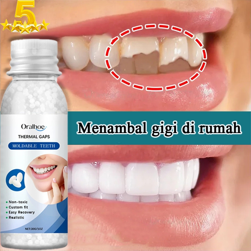 【Penjualan Laris 2025】gigi ompong penambal，Perbaiki gigi Anda dengan cepat（gigi ompong palsu，bahan t