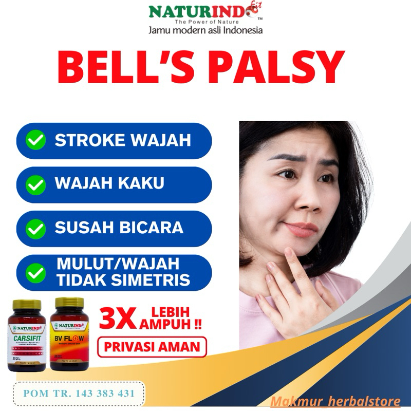 Obat Herbal Bell's Palsy Stroke Wajah Tidak Simetris Naturindo
