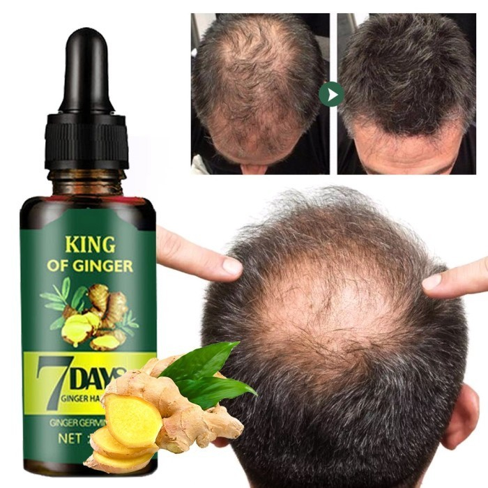[ORIGINAL 100%] SERUM PENUMBUH RAMBUT BOTAK & RONTOK I SERUM RAMBUT RONTOK IMEGES GINGER OIL SERUM I