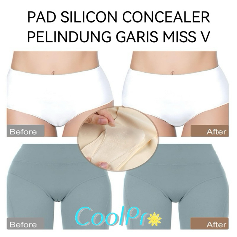 Coolpro - Camel Toe Concealer Pad | Silicon Pelindung Garis Kipatan MissV Bantalan Pelindung Under W